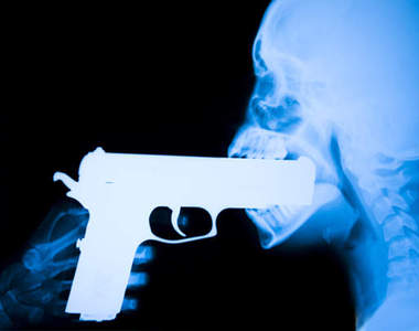 驚悚X光照 別把這麼大一根給塞進去