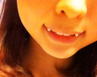 想要小惡魔般的虎牙♥就算馬麻沒生給妳也沒關係！