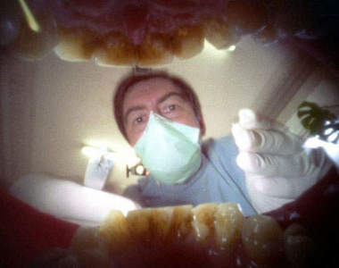 口內攝影：張嘴拍出的另一個世界～