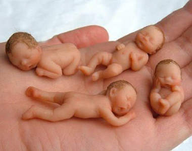 拇指姑娘的真人真事版！？