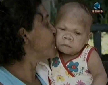 30歲不老嬰兒 9個月的外表 班傑明真實版?