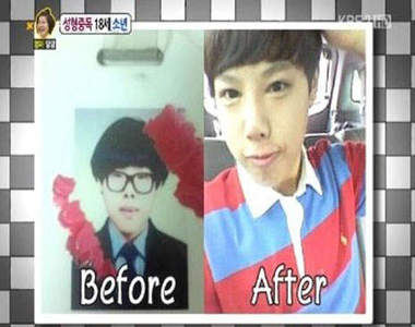 18歲《整形中毒男》 目標是整到滿意為止