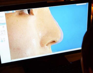 再也不用害怕整形失敗！？模擬整形後的3D機器登場！