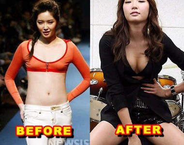 韓星的胸部 Before&amp;After