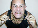 Bling Bling 的鑲鑽牙套 Bling Bling 的鑲鑽牙套