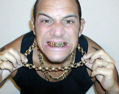 Bling Bling 的鑲鑽牙套