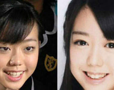 日本流行全臉整型?!