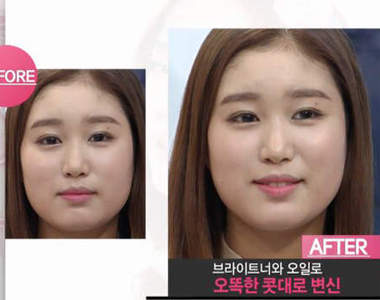 韓妞立馬美《川字打亮法》　不用挨針也能讓鼻子變挺啦～