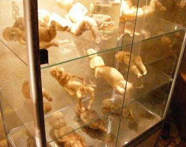 【閱覽絕對注意】畸形兒解剖標本～超驚悚的博物館展品～你有膽去看嗎…