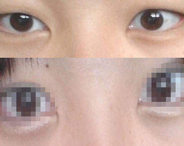 《雙眼皮化妝術》這到底差在哪？