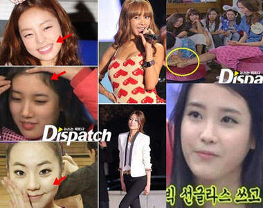 知名韓星也有在外貌上想要加強的部位...