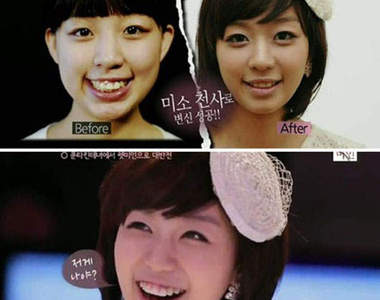 韓國新節目　免費幫素人整形