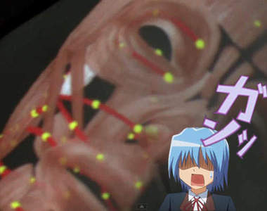 顏面神經觀測器 這根本就是裸體眼鏡的翻版嘛