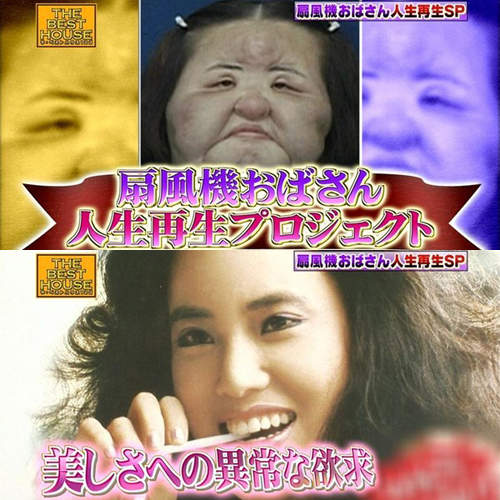 整形依存的 電風扇阿姨 日本節目幫助重生後的臉會變怎樣呢