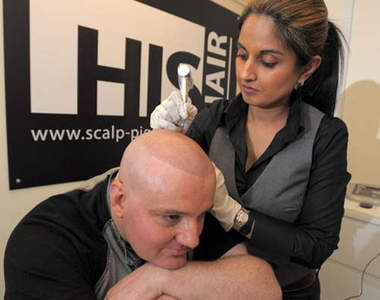 《頭髮刺青》改善禿髮情況的新方法！？