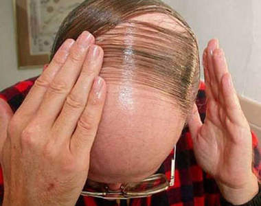 《禿頭髮型》帥氣髮型圖鑑