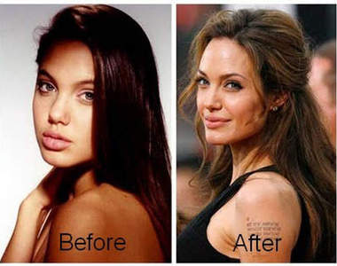 《老外最愛整型部位》跟東方人有一樣嗎～？