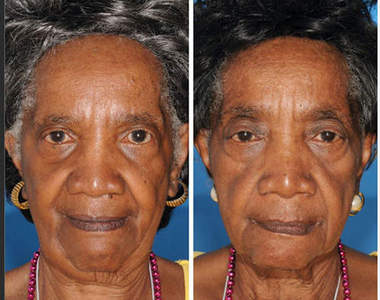 吸煙影響老化嗎？看看雙胞胎的變化就知道～