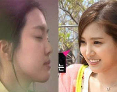 我結最年輕夫妻《A Pink 孫娜恩》被爆整形?!