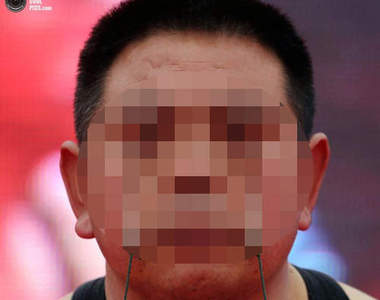 《眼皮特技》吊水桶　內有噁圖請慎入