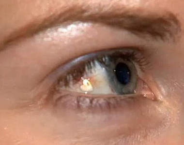 歐美另類《電眼手術》這樣真的有比較美麗嗎ಠ_ಠ？