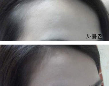 高額頭救星《髮際陰影膏》人家不想當清朝人了啦~