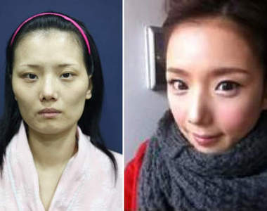 《自然風整形實錄》？這樣真的有比較自然⊙＿⊙？