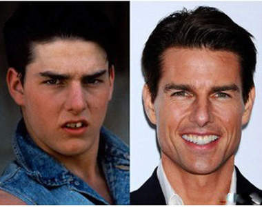 《明星整牙Before&After》根本是從路人變巨星嘛