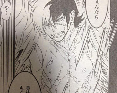 《青年怪醫黑傑克》日本新版漫畫有夠逼--老闆給我來十本(拍桌)