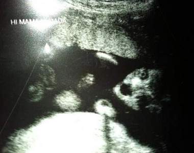 《恐怖超音波寶寶照》難道他們是上帝派來的小惡魔嗎~``~?