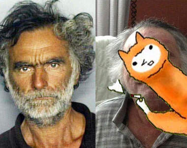 〝閱覽注意級〞邁阿密食臉男事件受害者最新恢復照片