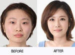 《整形before&after》特輯 有些根本不需要動刀吧...... 《整形before&after》特輯 有些根本不需要動刀吧......