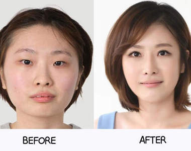 《整形before&after》特輯 有些根本不需要動刀吧......