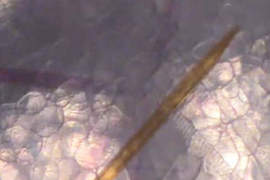 蚊子叮咬仔細看　顯微鏡下的吸血過程全公開