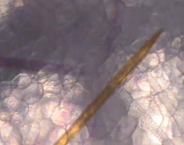 蚊子叮咬仔細看 顯微鏡下的吸血過程全公開