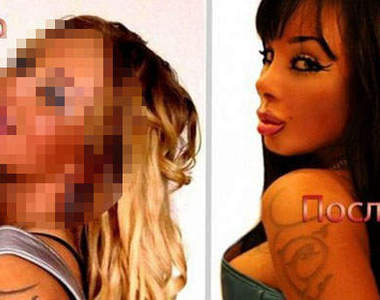 俄  網路歌手《Alena Piskun》為了美麗整張臉都豁出去⊙_⊙