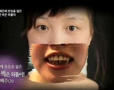 韓《黑牙妹大改造》妳終於能露出久違的笑容了ಥ_ಥ