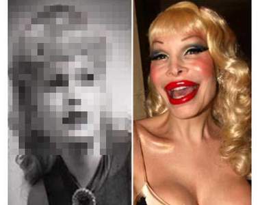 《整過頭名人》不是不能整 但要適可而止...