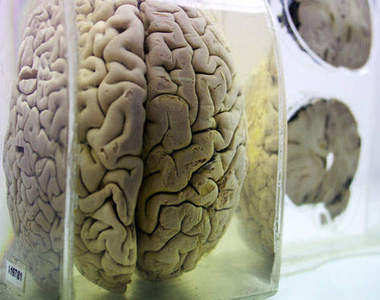 印度大腦博物館 一個腦~兩個腦~三個腦~四個腦...