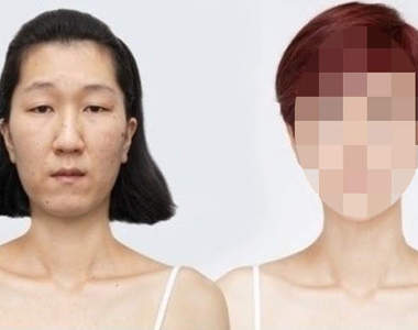 韓《老臉女大變身》整形費用高達9477萬韓元！！
