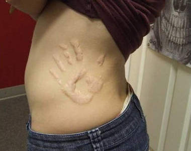 《疤痕紋身》看了就覺得好痛喔...（血腥照慎入）