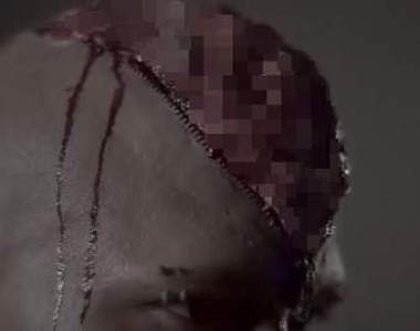 頭破血流《開腦萬聖節化妝術》腦子都開了還不給我第一名（伸）