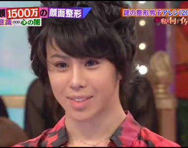 日本千萬整形男《Allen》所有費用竟然全靠年上女友們支出？！