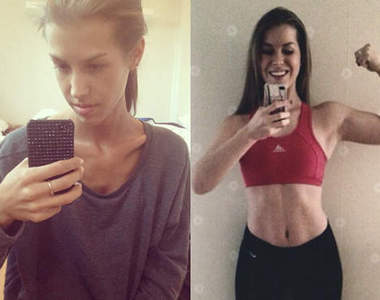 Instagram爆紅 超勵志《厭食症女孩》戰勝病魔