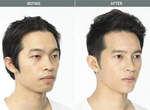 《整形before&after》趴兔 回到家媽媽都認不出來了吧...... 《整形before&after》趴兔 回到家媽媽都認不出來了吧......