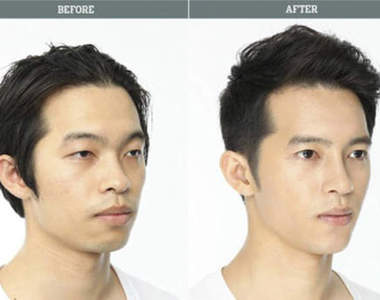 《整形before&after》趴兔 回到家媽媽都認不出來了吧......