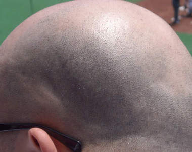 禿頭的好處　日本網友超心酸的重點分析