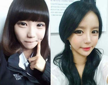 2013《最強整形王》到底誰崩壞的最嚴重呢？(誤)