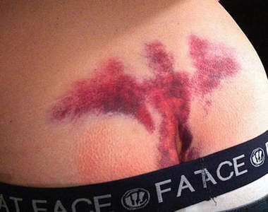 屁股出現天使的人  原來長這樣子