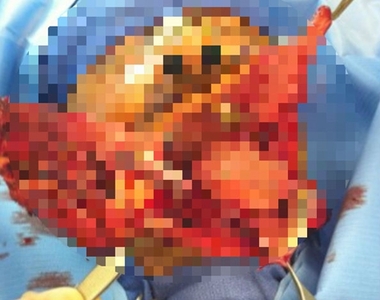 【閱覽注意】《Instagram人體解剖記錄》可、可以整篇都馬賽克嗎?(哭)